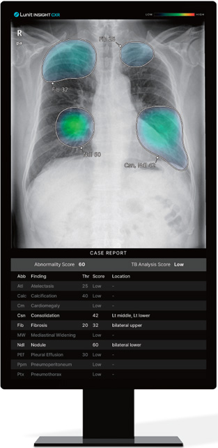 Lunit Insight CXR
