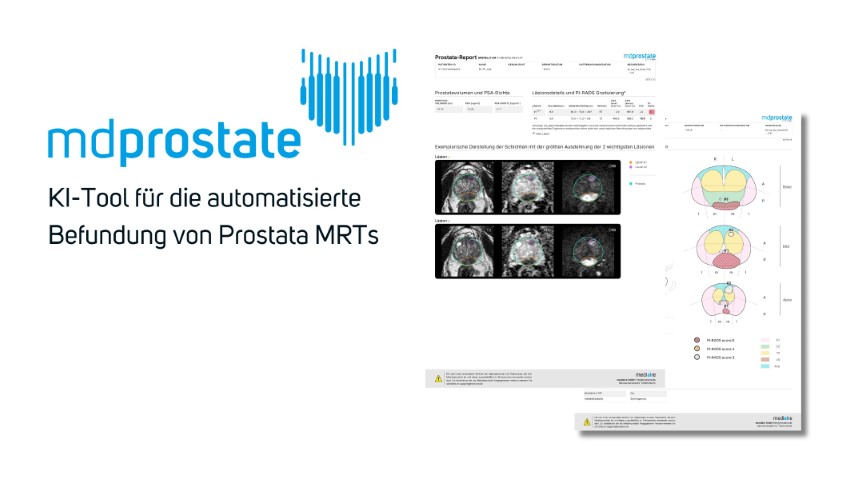 mdprostate